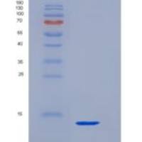 人T-细胞表面糖蛋白CD3ε(CD3e)重组蛋白His Tag