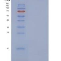 人白细胞介素-8/CXCL8重组蛋白aa 23-99
