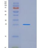 大鼠催乳素受体(PRLR)重组蛋白His tag