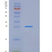 大鼠催乳素受体(PRLR)重组蛋白His tag