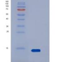 人野鼠色基因相关蛋白(AGRP)重组蛋白His tag