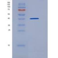 小鼠BAMBI / NMA 重组蛋白Fc tag