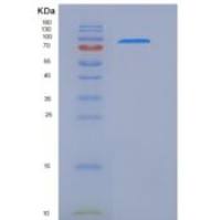 大鼠HER2 / ErbB2重组蛋白Fc tag