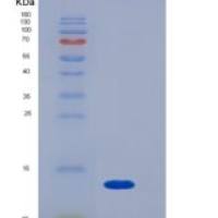 大鼠β2-微球蛋白(b2M)重组蛋白His tag
