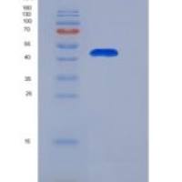 人EBP1 / PA2G4重组蛋白His tag