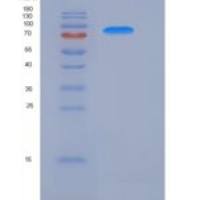 人ATF2重组蛋白His & GST tag