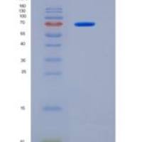 人MTSS1重组蛋白aa1-250, His & MBP tag