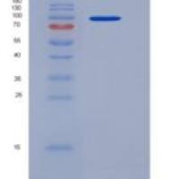 人AGO3 / Argonaute 3 / EIF2C3重组蛋白His tag