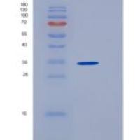 人Follistatin / FST重组蛋白His tag