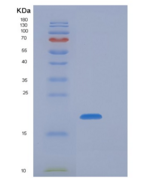 小鼠NKG2A / NKG2 / CD159A / KLRC