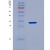 人CD46重组蛋白His tag