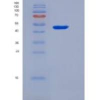 人色氨酸羟化酶1(TPH1)重组蛋白His tag
