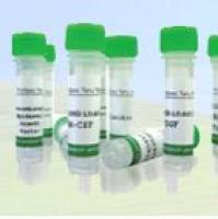 Recombinant Human Bone Marrow Stromal Cell Antigen 1