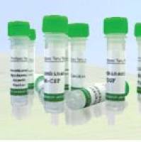 Recombinant Human Bone Marrow Stromal Cell Antigen 2