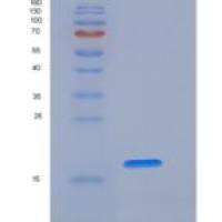 人凋亡相关因子(FAS)重组蛋白His Tag