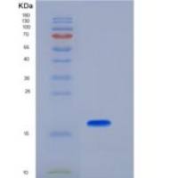 小鼠过氧化还原酶5(PRDX5)重组蛋白His tag