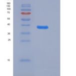 人肾上腺髓质素(ADM)重组蛋白Fc tag