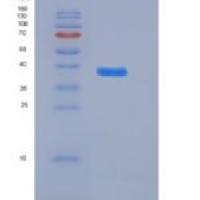 人肾上腺髓质素(ADM)重组蛋白Fc tag