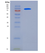 人GAD65 / GAD2 / GAD-2重组蛋白GST T