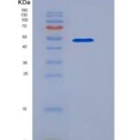 小鼠HMGB1 / HMG1重组蛋白Fc tag