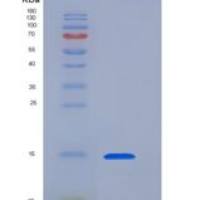 人Dectin-1重组蛋白