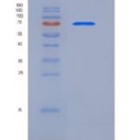 人钙网蛋白(CALR)重组蛋白Fc tag