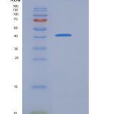 人PRMT6 / HRMT1L6重组蛋白His & FLAG tag