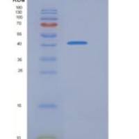人PRMT6 / HRMT1L6重组蛋白His & FLAG tag