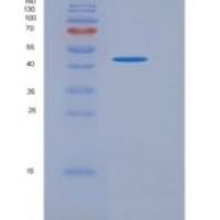 人Nei内切核酸酶Ⅷ样蛋白1(NEIL1)重组蛋白His tag