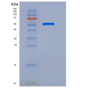 人TEM8重组蛋白Fc Tag