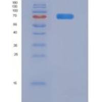 人法尼基二磷酸合酶(FDPS)重组蛋白