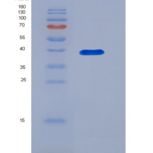人二肽酶2(DPEP2)重组蛋白His tag