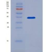 人二肽酶2(DPEP2)重组蛋白His tag