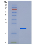 人PTH1R重组蛋白His Tag