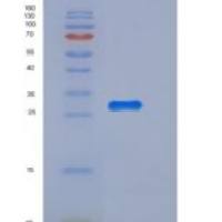 小鼠泛素羧基端酯酶L3(UCHL3)重组蛋白His tag
