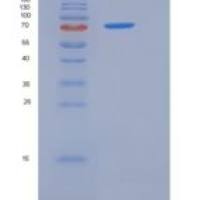 大鼠PCSK9 / NARC1重组蛋白His tag
