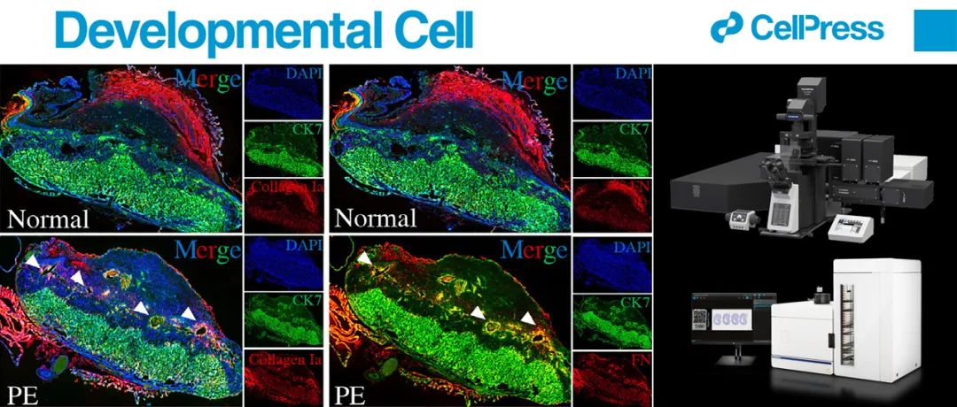 EVIDENT助力谭彬/童超/漆洪波团队揭示内皮祖细胞影响子宫螺旋动脉重铸调控子宫-胎盘循环的建立