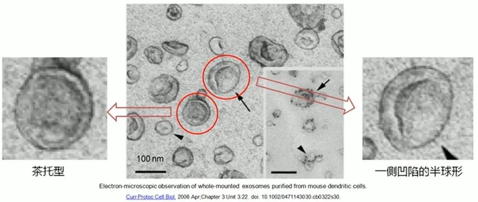外泌体电镜 (2).jpg