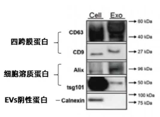 外泌体的鉴定方式