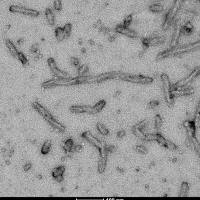 Tau441(2N4R), P301S 突变蛋白纤维