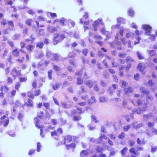 RM-1细胞、RM-1细胞、RM-1细胞