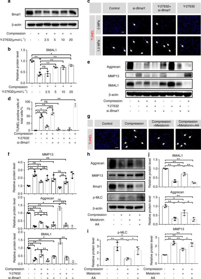 恢复核心生物钟分子 BMAL1 的抑制表达可防止压缩诱导的椎间盘退变