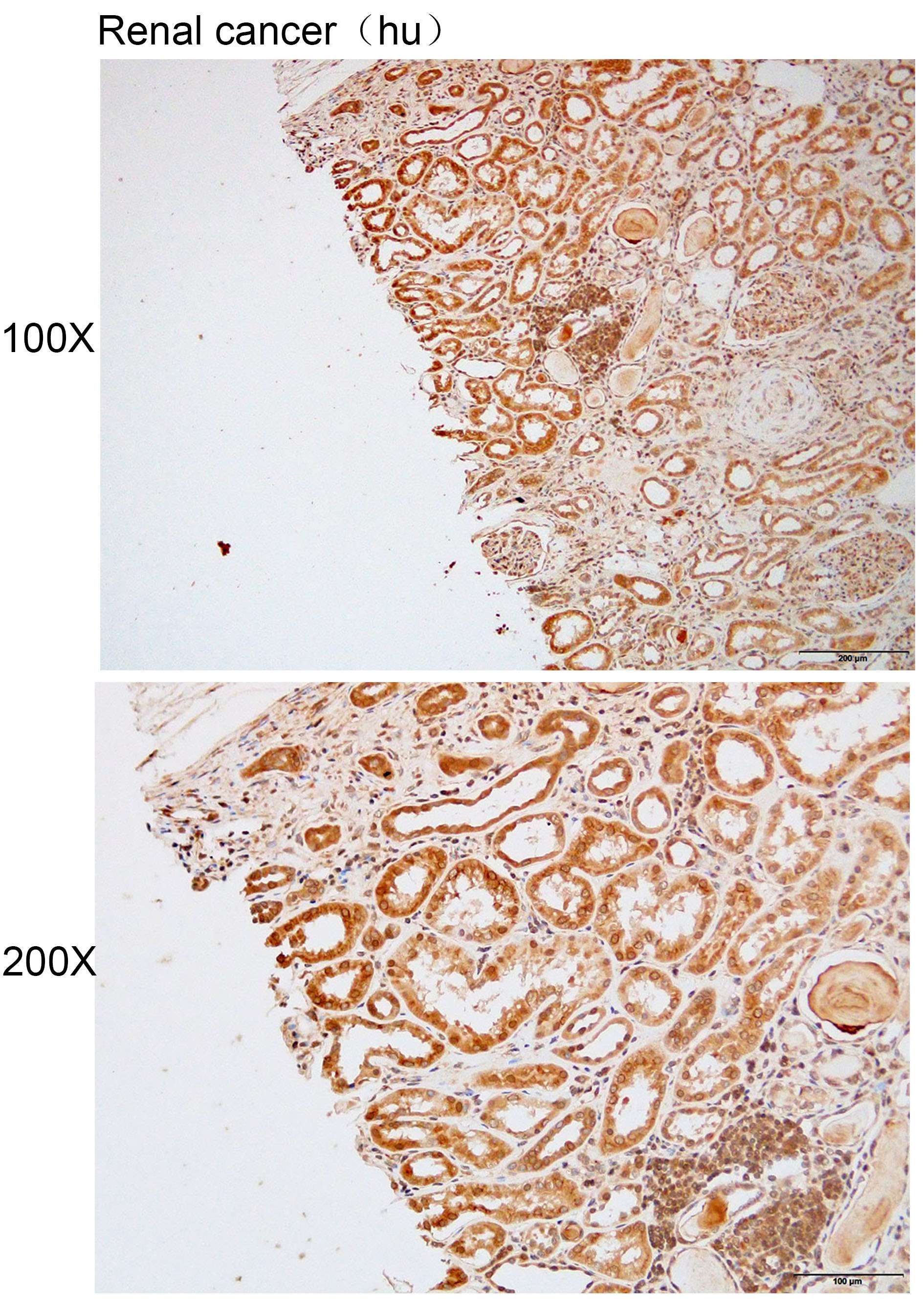 Anti-ANKRD13A Polyclonal Antib