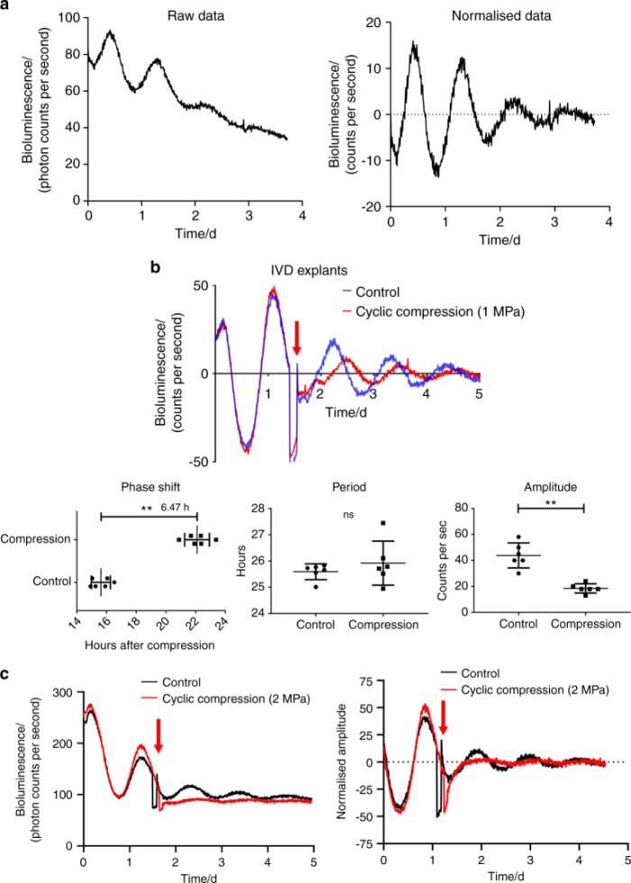 恢复核心生物钟分子 BMAL1 的抑制表达可防止压缩诱导的椎间盘退变