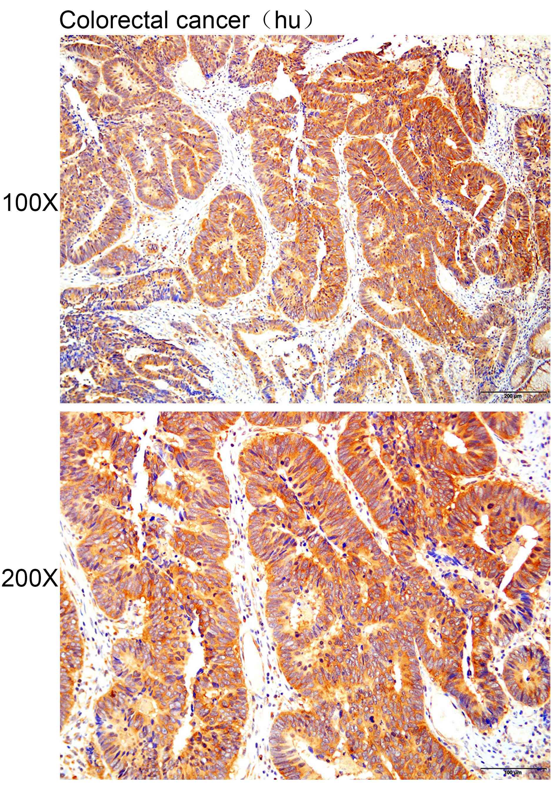 Anti-ANKRD39 Polyclonal Antibo
