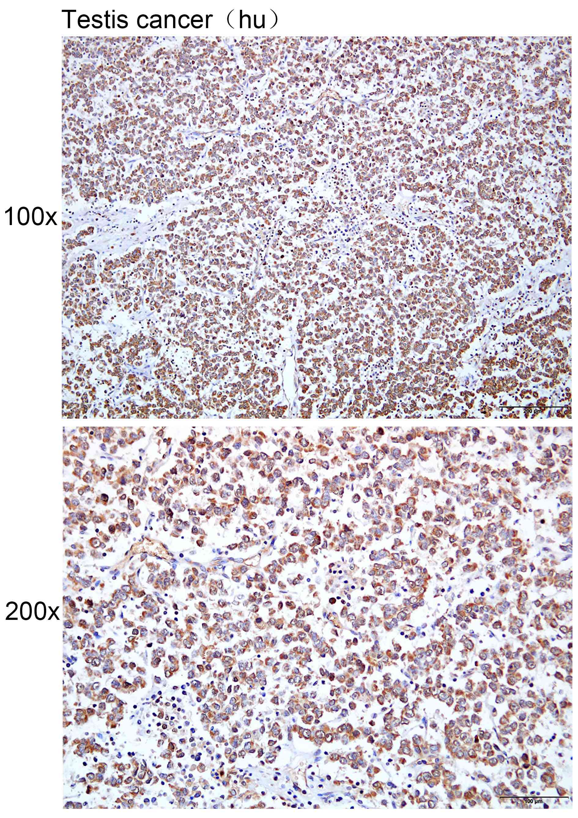Anti-AK8 Polyclonal Antibody