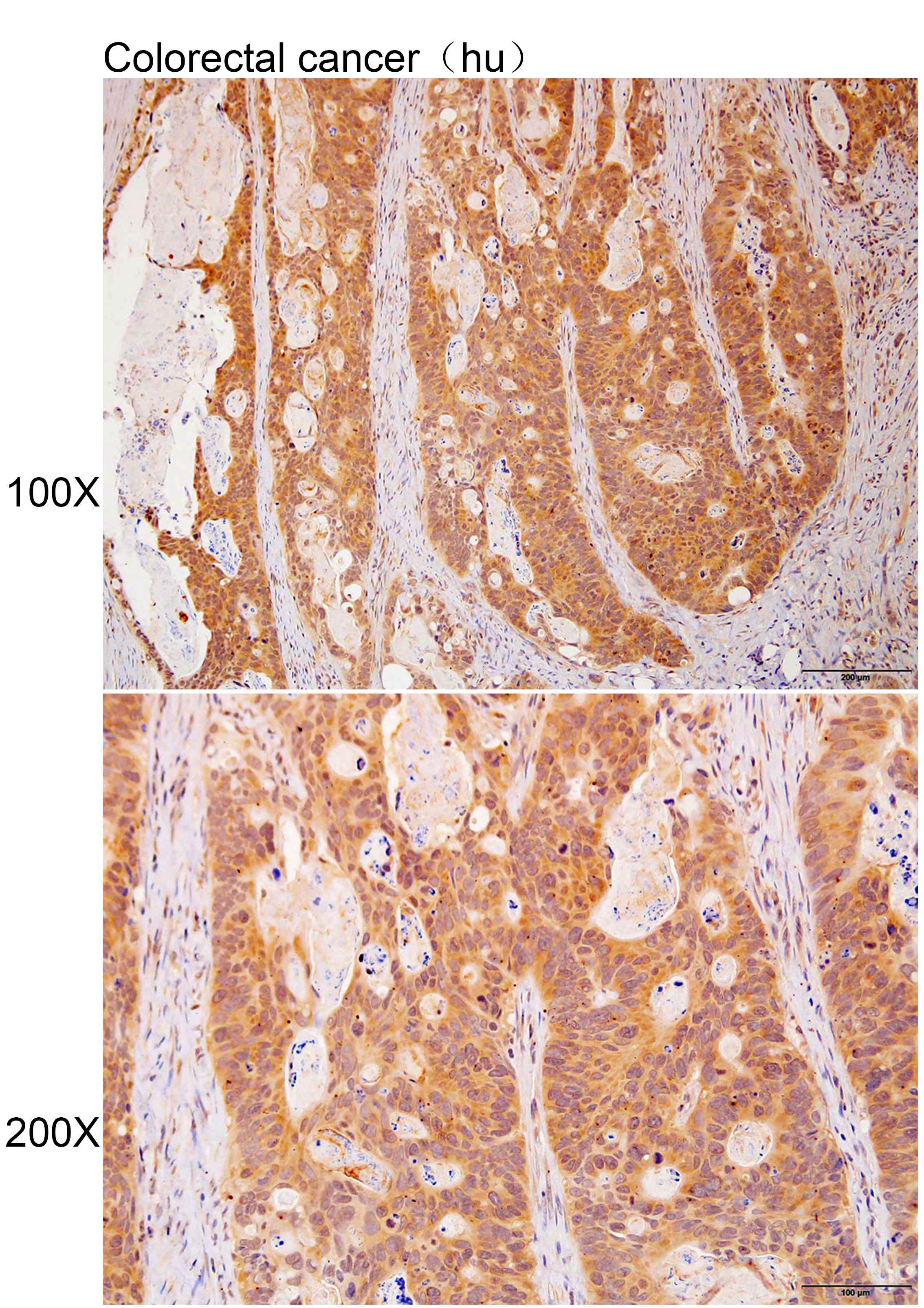 Anti-ANKRD27 Polyclonal Antibo
