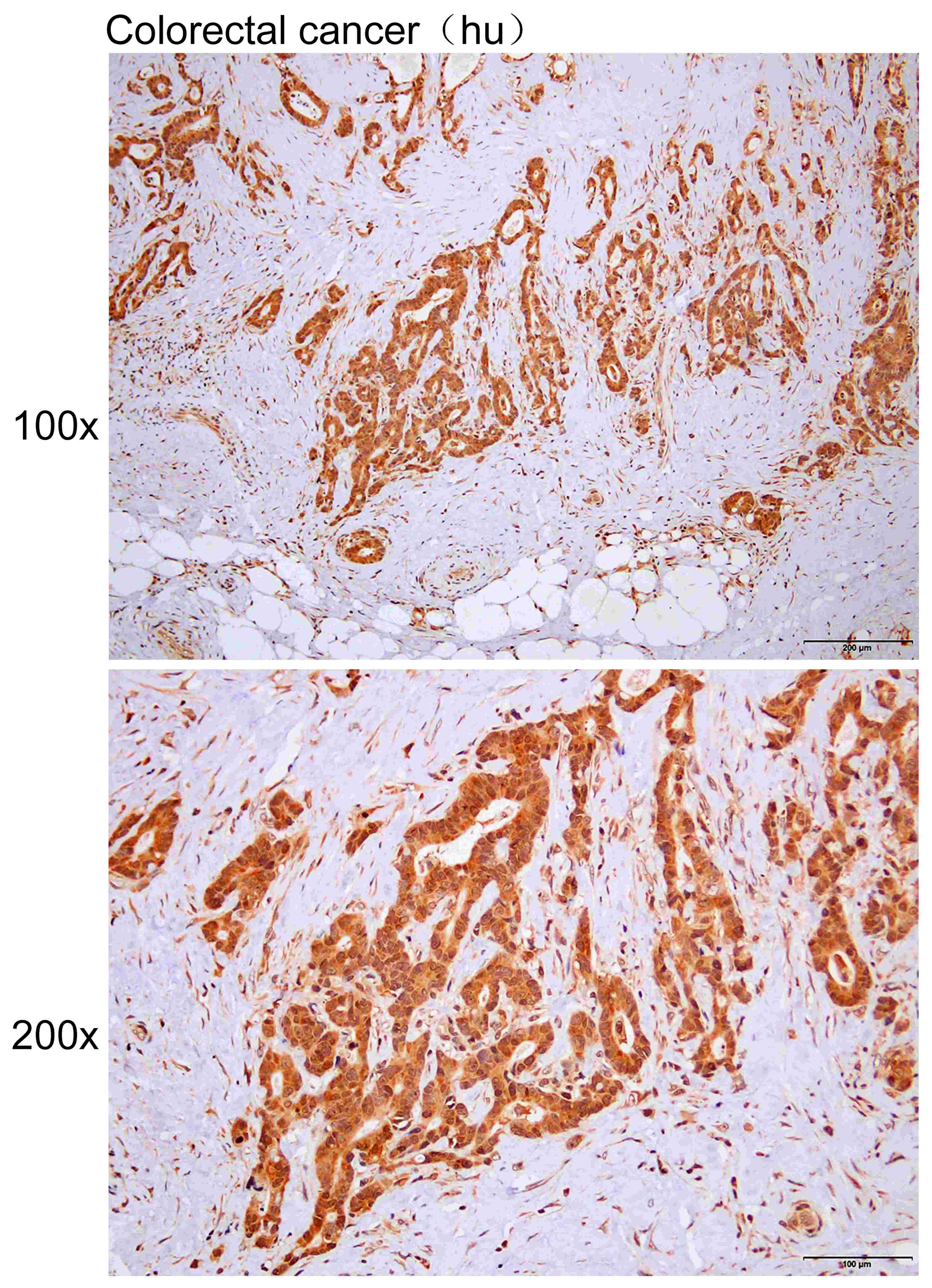 Anti-AK5 Polyclonal Antibody