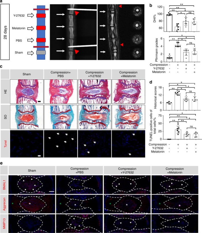恢复核心生物钟分子 BMAL1 的抑制表达可防止压缩诱导的椎间盘退变