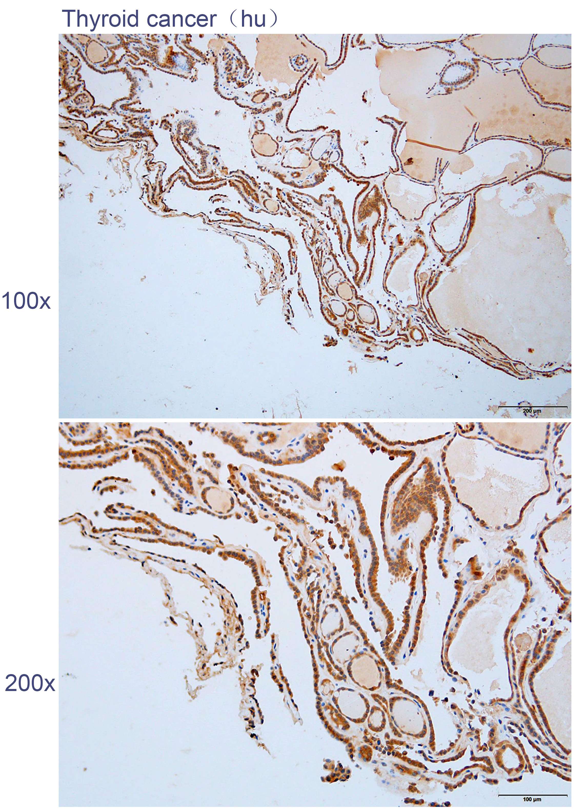 Anti-ANKRD45 Polyclonal Antibo